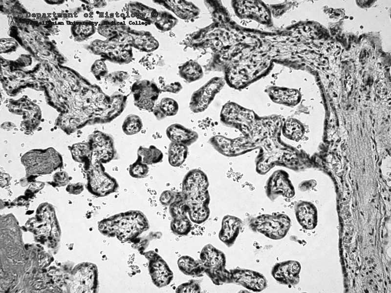 nacieka endometrium,