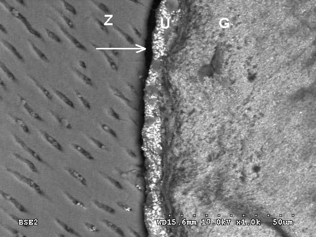 Widoczne dobre przyleganie uszczelniacza (U) do zębiny (Z) i gutaperki (G). Powiększenie 1000. Ryc. 4.