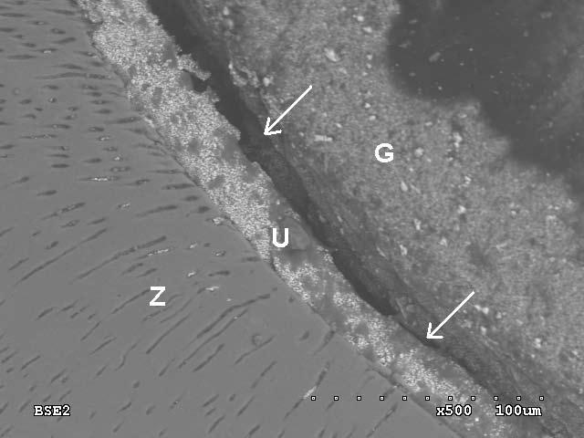 Widoczne miejsca dobrego i niewłaściwego (strzałki) przylegania uszczelniacza (U) do zębiny (Z) i gutaperki (G). Powiększenie 1000. Ryc. 6.