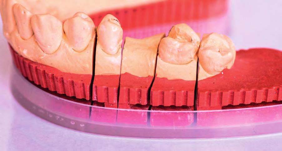t ec h n i k a dentyst yc z n a Do pierwszej grupy zaliczamy systemy oparte na skanowaniu wewnątrzustnym łuków zębowych i internetowym przesłaniu zapisanych w plikach danych do pracowni protetycznych.