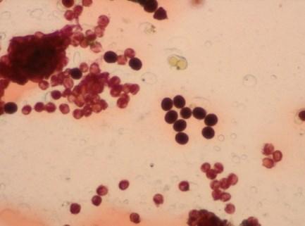 Date of observatio n Distance of Hirst-type volumetric pollen trap from the field 2011 2012 2013 90 m 180 m 10 m 100 m 15 m 100 m A* B** A* B** A* B** A* B** A* B** A* B** 30 April 257 35.69 58 8.