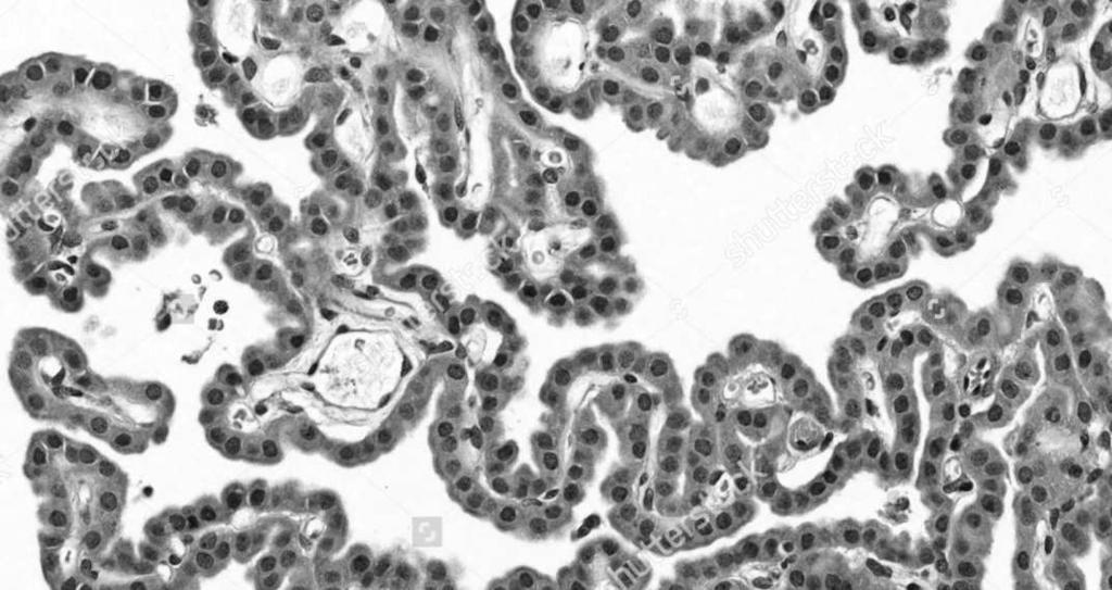 miękka: delikatna tkanka łączna wiotka pokryta warstwą fibroblastów.