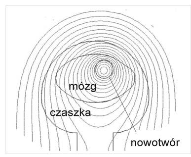 Nadprzewodniki wysokotemperaturowe jako generatory i detektory.