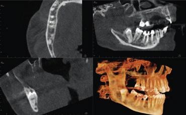 Wysoka jakość obrazu, prosta obsługa: ekran dotykowy SmartScan STUDIO Oprogramowanie dopasowane do Twoich potrzeb Teraźniejszość: kompleksowa diagnostyka Przyszłość: pełna integracja danych