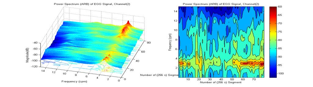 Filtered EGG Signal (uv) Filtered EGG Signal & Window (uv) Laboratoria Katedry Biosensorów i Przetwarzania Sygnałów Biomedycznych Power Spectrum Density (db) Przetwarzanie sygnałów biomedycznych