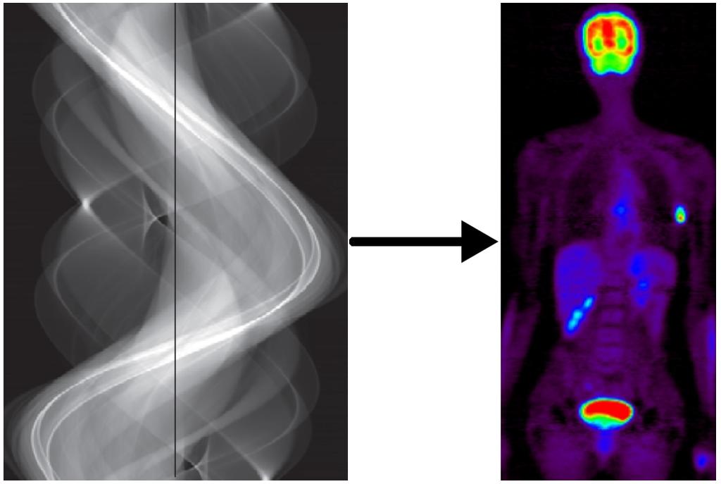 Pozytonowa tomografia emisyjna Dedykowane algorytmy komputerowe rekonstuują na tej podstawie rozkład źródeł emisji (podobnie jak w przypadku CT) Musimy