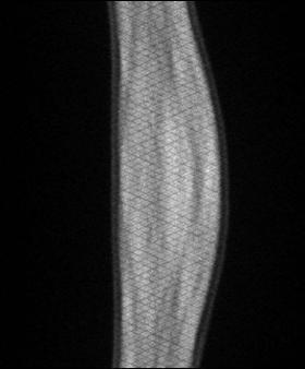 Sinogram r r r Projekcja(r, )