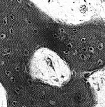 Nazwa Osteonektyna Osteokalcyna Osteopontyna Sialoproteina II Fibronektyna Enzymy: