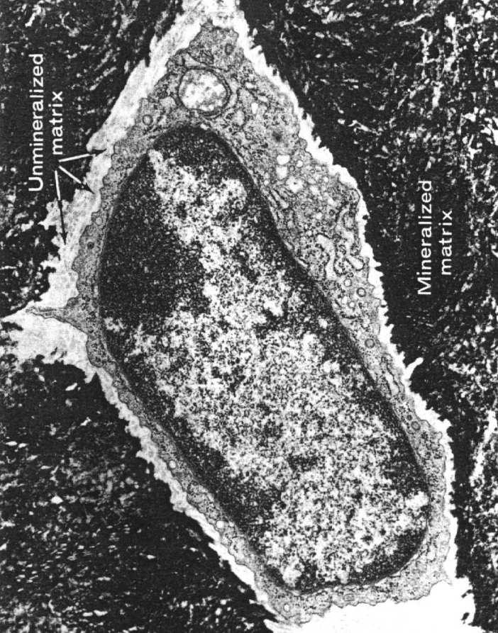 (nieprzepuszczalnymi) ścianami jamek i kanalików obszar zmineralizowany Stany czynnościowe osteocytów
