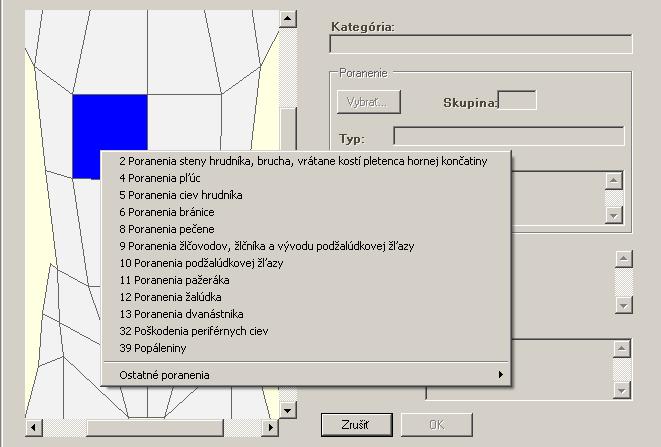 Obr. 7 Zobrazenie použitia klasifikačných tabuliek v programe PC Fortis Obr.