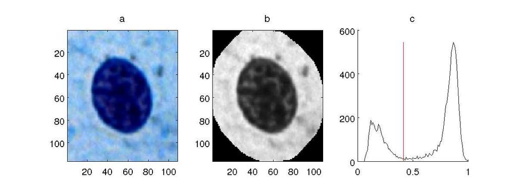 Adaptacyjna metoda poprawy kontrastu dla cyfrowych obrazów rozmazów cytologicznych Algorytm zmiany kontrastu wykorzystuje następujący wzór dla wartości każdego piksela z każdego kanału koloru X do