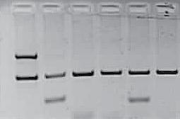 P R A C E K A Z U I S T Y C Z N E Orzińska A, et al. Wyniki W DNA wyizolowanym z osocza ciężarnej wykryto ekson 7, ekson 10 i intron 4 genu RHD.