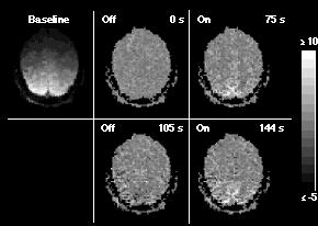 Aktywacja fmri Migocząca szachownica OFF