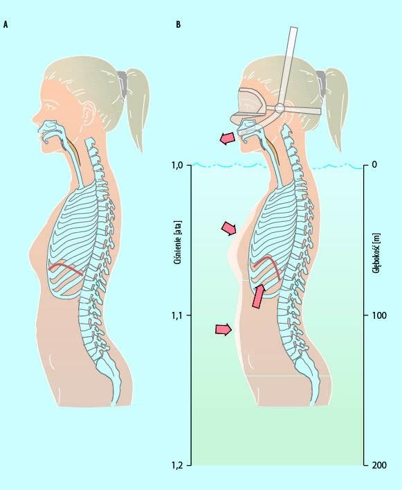 Układ oddechowy a nurkowanie I grupa chorób Oddychanie sprężonymi gazami w warunkach nurkowania i hiperbarii ma znaczny wpływ na mechanikę oddychania.