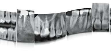 Obrazowanie wewnątrzustne Planmeca ProSensor HD Sprawdzona użyteczność jak nigdy dotąd Nasza innowacyjna radiografia cyfrowa Planmeca ProSensor HD gwarantuje unikalne połączenie jakości