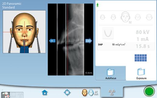 Planmeca ProMax 2D Doskonałe zdjęcia panoramiczne za każdym razem Wyobraź sobie, że Twój aparat RTG może rozpoznawać anatomię pacjenta Nasz unikalny Autofocus dla aparatów Planmeca ProMax 2D S3