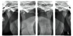 Programy TMJ wielokątowe tworzą zdjęcia radiograficzne z obrazami pod trzema różnymi kątami w projekcjach bocznej lub PA.