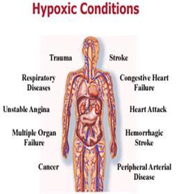 HIPOKSJA Stan kliniczny, w którym utlenowanie tkanek jest niewystarczające Może występować