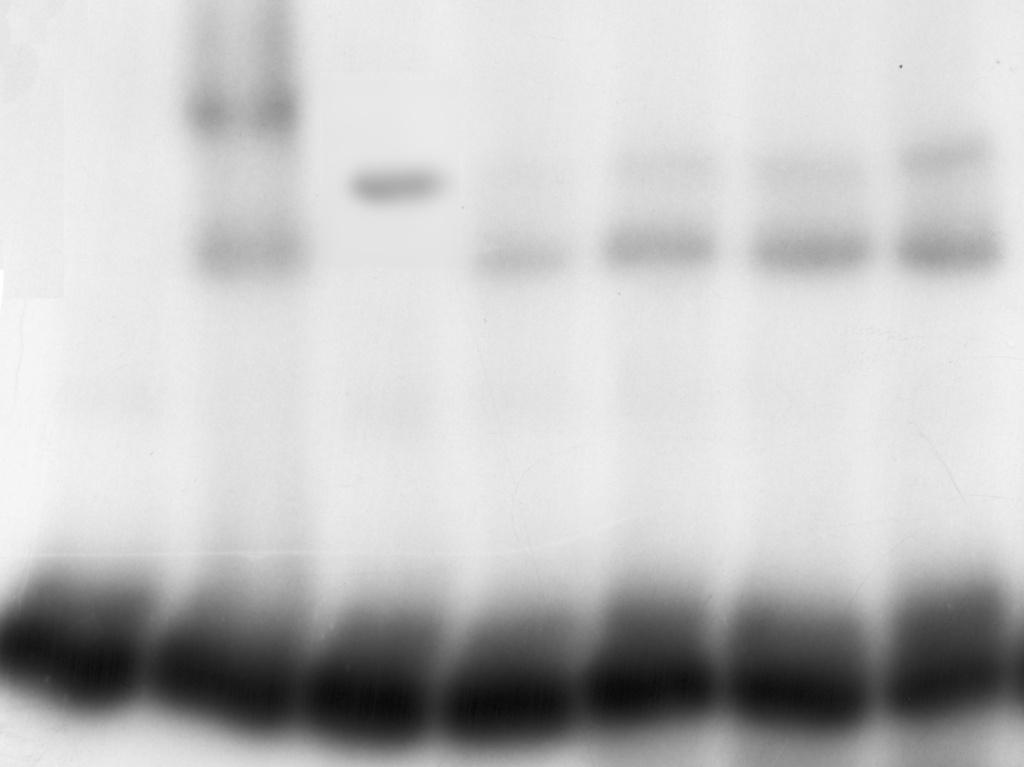 Wyniki Białko FR3 zawierające domenę 3 i 4 dzikiej podjednostki sigma tworzy z rdzeniem i DNA (Fot. 20, 22 i 23) dwie formy kompleksu podobnie jak w przypadku białka FR2. 1 2 3 4 5 6 7 Fot.