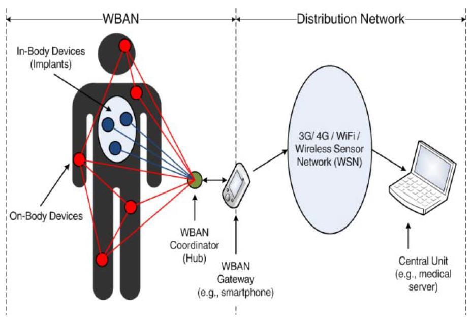 Przykład rodziny układów typu: Body sensor networks bioczujniki+algorytmy+jednostki