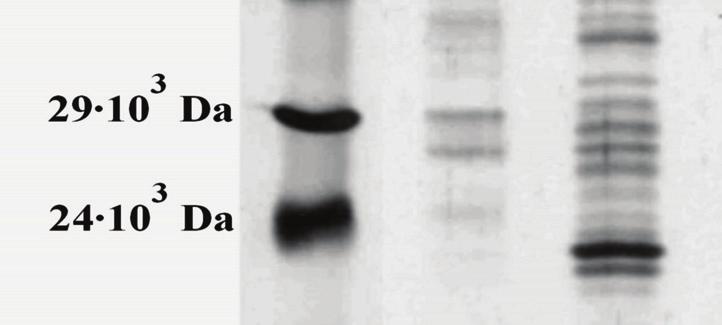 The influence of the nutrients availability in the medium on extracellular protein profile of Proteus vulgaris cells (B - incubated under starvation conditions,