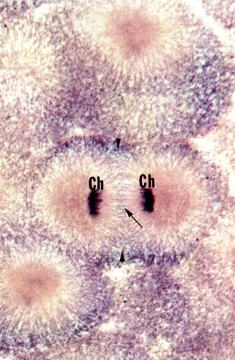 Mitoza dwubiegunowe wrzeciono 3. Podział mejotyczny (preparat nr 69-L). 4. Jądro i jąderko (TEKST I EM N/3/1). 5. Chromatyna płciowa (EM 2/2). 7.