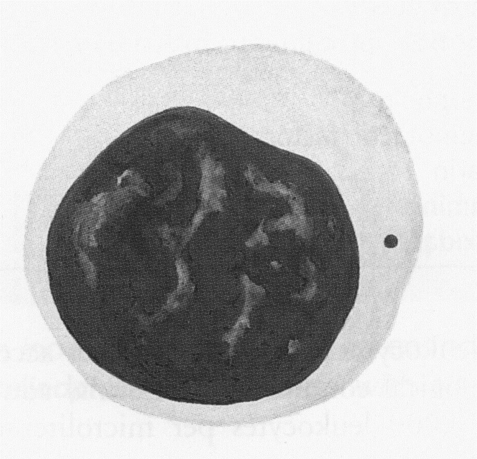 Preparat histologiczny szpiku czerwonego (preparat nr 35, widok ogólny - p. m.; komórki szpiku, megakariocyty - p. d.). 4. Kościotworzenie przez przeszczep zrębu szpiku do nerki (preparat nr 56 - p.