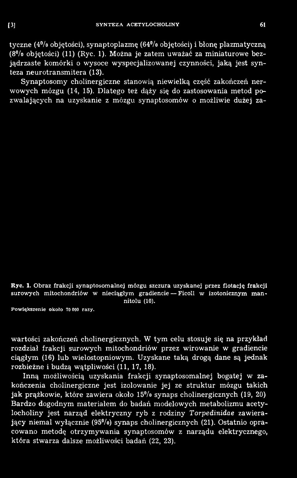 Obraz frakcji synaptosom alnej mózgu szczura uzyskanej przez flotację frakcji surow ych m itochondriów w nieciągłym gradiencie Ficoll w izotonicznym man> nitolu (10).