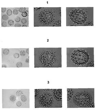 Morphology of pollen grains... 139 Frankasol, the mean value was 4.5 µm (3.31-5.57 µm), and the shortest for the Wielkopolski variety the mean value 3.46 µm (.54-4.49 µm).