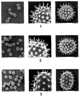 140 M. Klimko, M. Kluza, A. Kreft Fig. 5. The pollen grains of Helianthus annuus L. under SEM microscope Ryc. 5. Ziarna pyłku Helianthus annuus L.