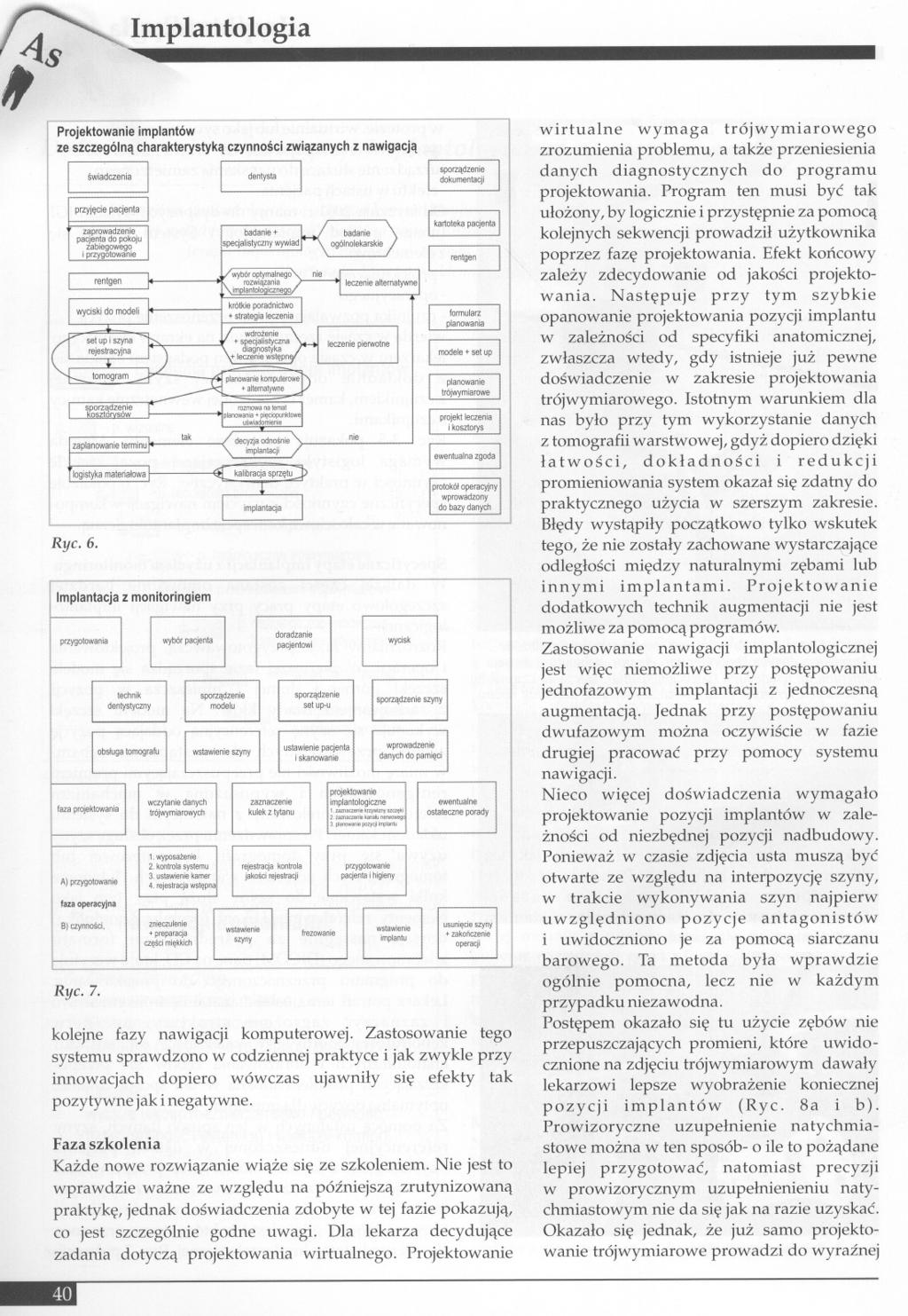 Implantologia Projektowanie implant6w ze szczeg6ln'l charakterystyk'l Ryc.6. Implantacja z monitoringiem przygotowama lazaprojektowania AI przygotowanie fazaoperacy)na BI czynnosci, Ryc.7.