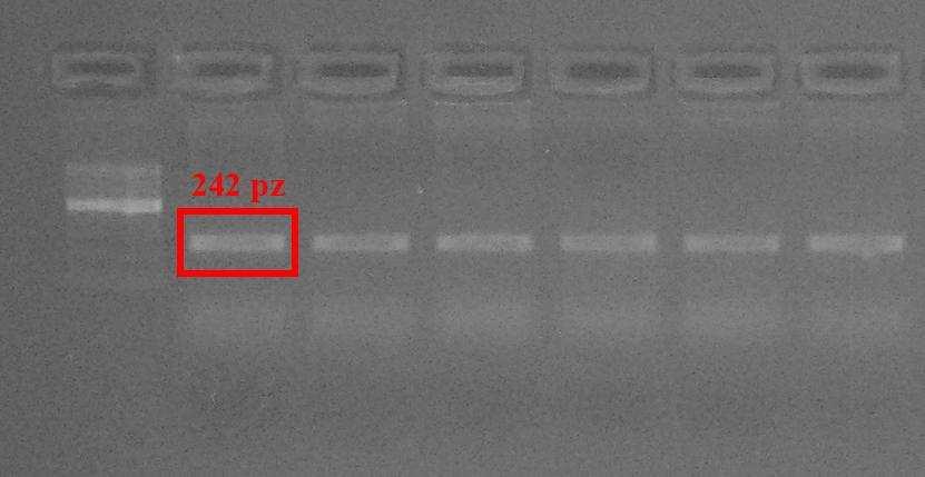 126 M. Wasilewska and S. Tabor-Osińska Fig. 1. The product of the PCR, the product's length 242bp Ryc. 1. Produkt PCR o długości 242pz Fig. 2. The product of the digestion all the variants of the polymorphism in the studied gene.