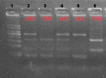 Ścieżka 1 marker, ścieżki 2 i 4 genotyp AG, ścieżki 3 i 6 genotyp GG, ścieżka 5 genotyp AA Table 1. The frequency of alleles and genotypes ERα/BglI in the herds tested Tabela 1.