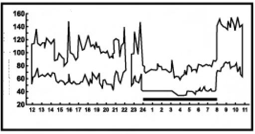 Poniższy wykres przedstawia pomiar ciśnienia w ciągu doby z odstępem 5 minutowym. Co to jest arytmia? Arytmia to jest problem polegający na zaburzeniu rytmu serca.