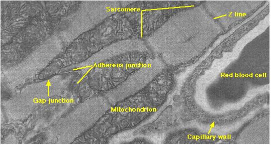 Cardiac Muscle 21 Cardiac or heart muscle resembles skeletal muscle in some ways: it is striated and each cell contains sarcomeres with sliding filaments of actin and myosin.