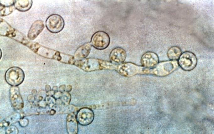 com/molds/aspergillus-fumigatus/ Zdolność wytwarzanie 2 różnych