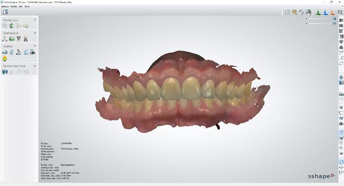 MOGUCERA C Skład chemiczny: Co, Cr, Mo WAK 20-500 C -14,6 Typ 4, zakres prac:  stopów dentystycznych.