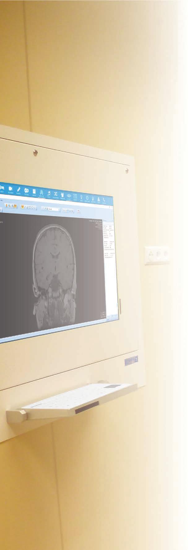 mianem radiologia cyfrowa określamy procedurę otrzymywania i przetwarzania obrazów cyfrowych. Po prześwietleniu pacjenta promieniami RTG obraz zapisywany jest w postaci cyfrowej.
