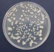 Ad. 3 Izolacja komórek bakteryjnych z materiału mikropoletkowegoprzeprowadzona została metodąposiewów na
