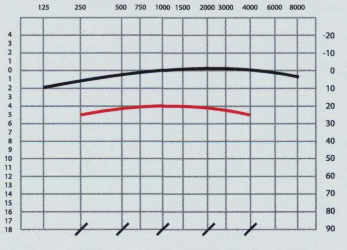 158 G. Szymańska Rys. 4. Krzywe uwagi słuchowej dla dźwięków zewnętrznych i wewnętrznych. Błędna lokalizacja źródła dźwięku dla częstotliwości 250-4000 Hz. 6.