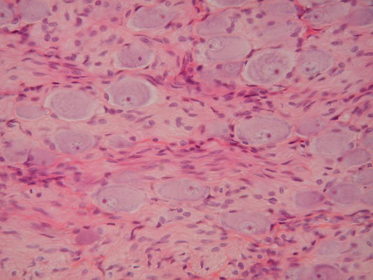 2. Ganglion /