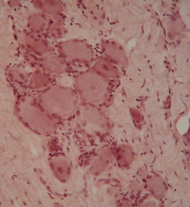 3. Neurons /
