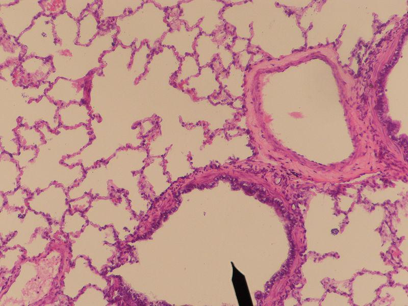 Urinary