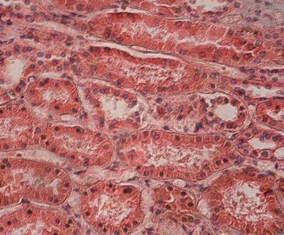Kidney /