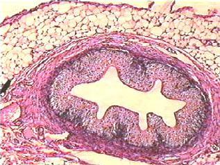 Ureter /