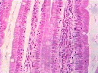 epithelium /