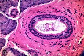 6. Stratified
