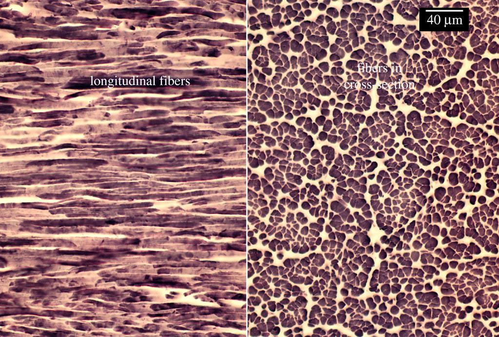 III. Connective tissue