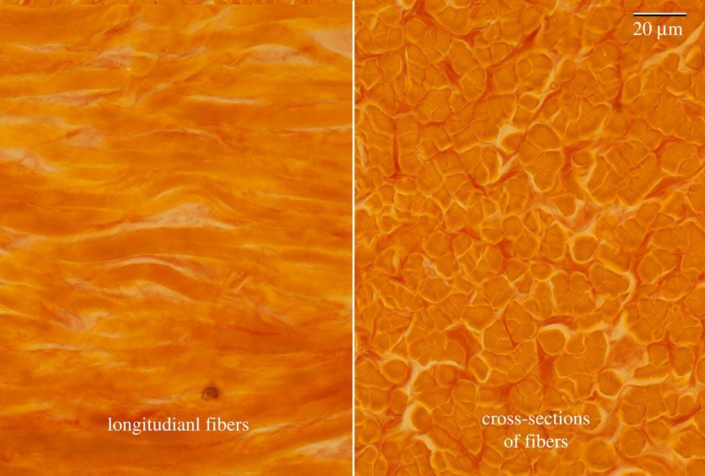 connective tissue /