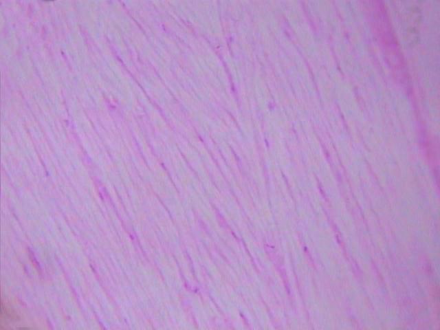 Dense connective tissue